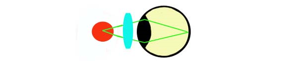 Глаз и зрение очки близорукость и дальнозоркость